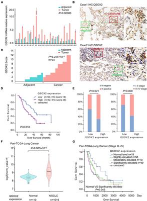 QSOX2 Is an E2F1 Target Gene and a Novel Serum Biomarker for Monitoring Tumor Growth and Predicting Survival in Advanced NSCLC